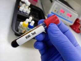 Muere niña mexicana de 3 años con gripe aviar, el primer caso humano en México