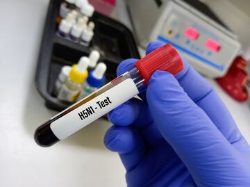 California en alerta: Declaran emergencia por gripe aviar H5N1