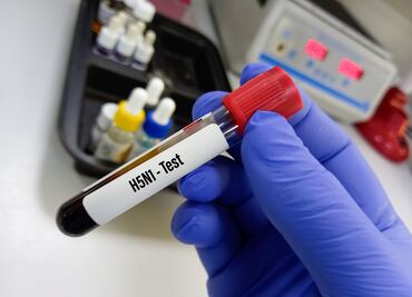 Muere niña mexicana de 3 años con gripe aviar, el primer caso humano en México