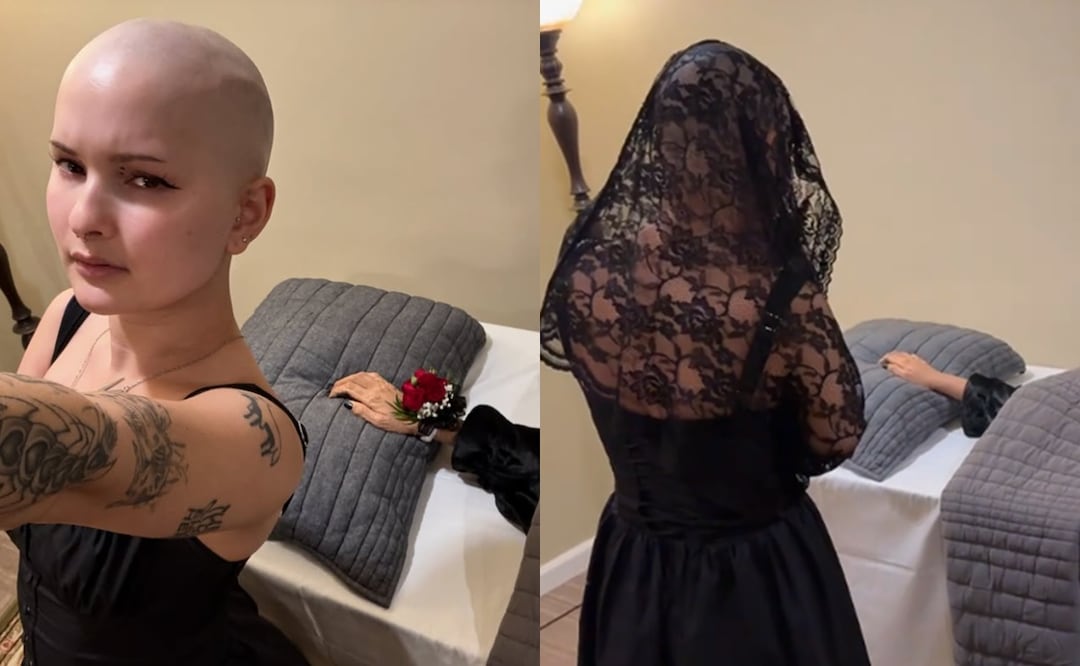 Influencer con cáncer le hace un funeral a su brazo amputado: “Es una experiencia bellamente catártica”. Foto: Captura Instagram
