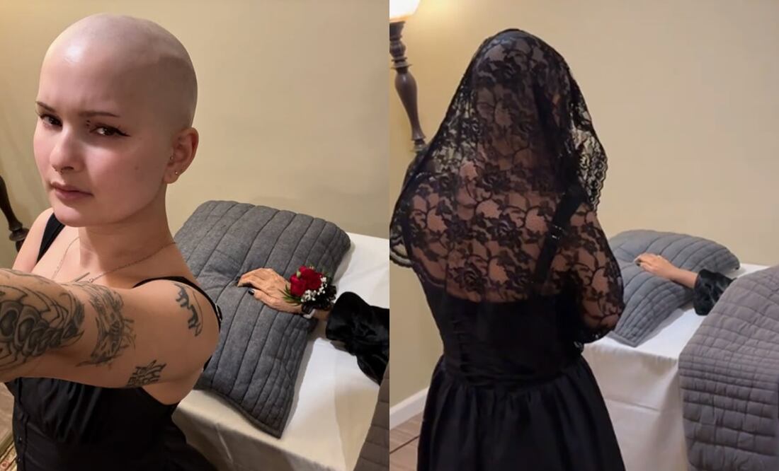Influencer con cáncer le hace un funeral a su brazo amputado: “Es una experiencia bellamente catártica”. Foto: Captura Instagram