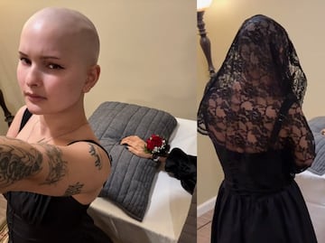 Influencer con cáncer hace un funeral para su brazo amputado: “Es una experiencia bellamente catártica”. VIDEO