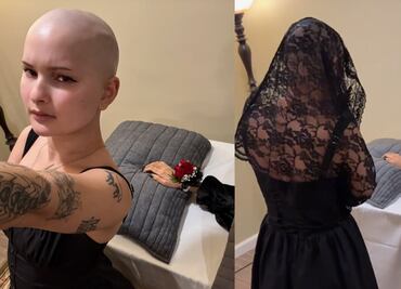 Influencer con cáncer hace un funeral para su brazo amputado: “Es una experiencia bellamente catártica”. VIDEO