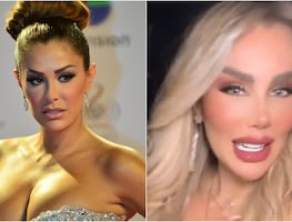 ¿La nueva Barbie humana? Critican a Ninel Conde por estar “más tuneada” que nunca