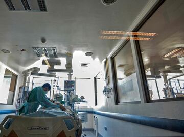 Fallece mujer que recibió riñón de un cerdo tres meses después del trasplante