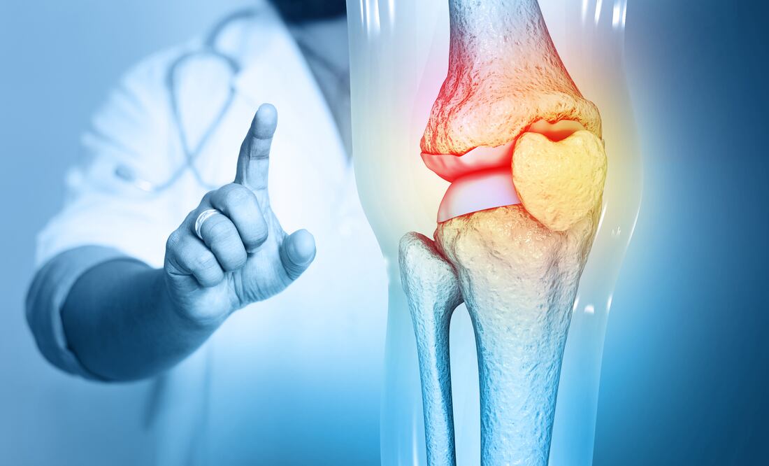 Osteoartritis/ iStock/Mohammed Haneefa Nizamudeen