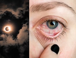 ¿Por qué no debes ver un eclipse solar directamente? ¿Qué y cómo te afecta?