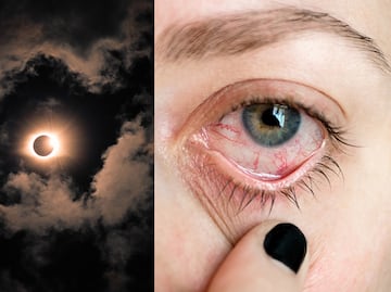 ¿Por qué no debes ver un eclipse solar directamente? ¿Qué y cómo te afecta?