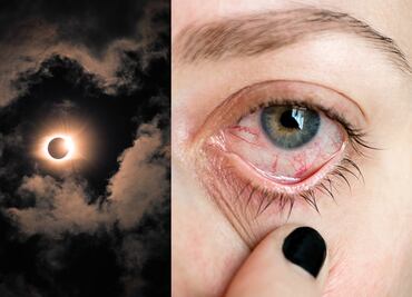 ¿Por qué no debes ver un eclipse solar directamente? ¿Qué y cómo te afecta?