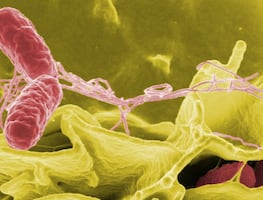 Alertan por brote de salmonela vinculado a suplemento: Importante tienda ya los retiró