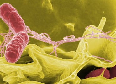 Alertan por brote de salmonela vinculado a suplemento: Importante tienda ya los retiró