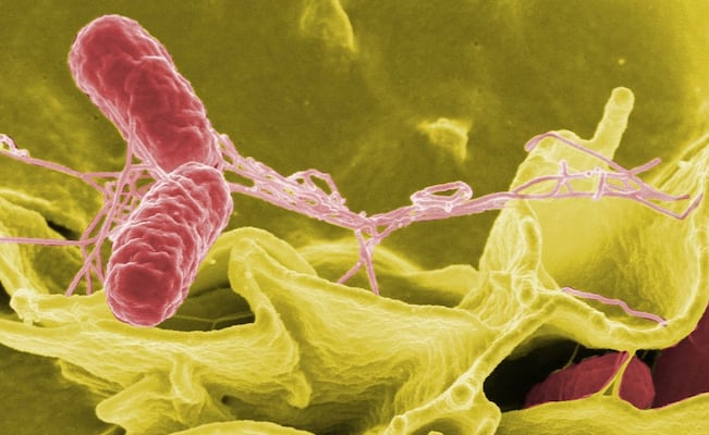 Alertan por brote de salmonela vinculado a suplemento: Importante tienda ya los retiró