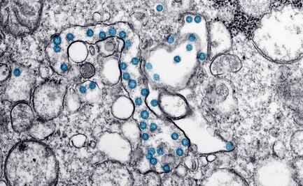 Cóctel de anticuerpos monoclonales 'neutraliza' el Covid-19 