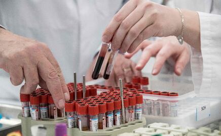 ¿Antiviral remdesivir ayuda a combatir al Covid-19?, China dice que no