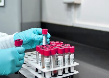 ¿Tener un cierto tipo de sangre te protege del coronavirus?