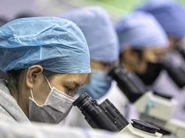 Así es cómo el coronavirus daña los pulmones: estudio