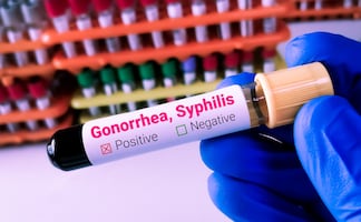 Estados Unidos enfrenta epidemia de Infecciones de Transmisión Sexual (ITS). ¿Qué es y cuáles son los síntomas?