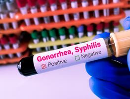 Estados Unidos enfrenta epidemia de Infecciones de Transmisión Sexual (ITS). ¿Qué es y cuáles son los síntomas?