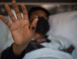 Casos de viruela del mono aumentan hasta 160% en África y alertan por riesgo de más propagación