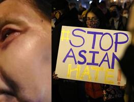 Golpean a mujer de origen mexicano en LA tras confundirla con asiática