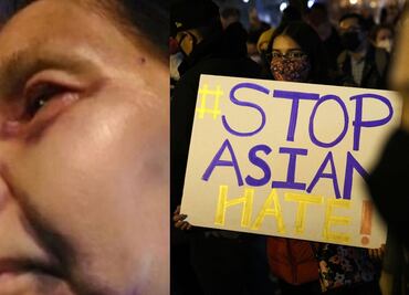 Golpean a mujer de origen mexicano en LA tras confundirla con asiática