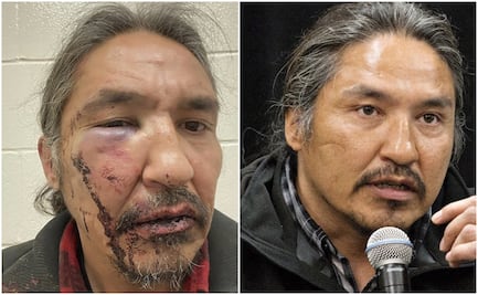 Video. Violento arresto policial contra jefe indígena; Trudeau condena acto