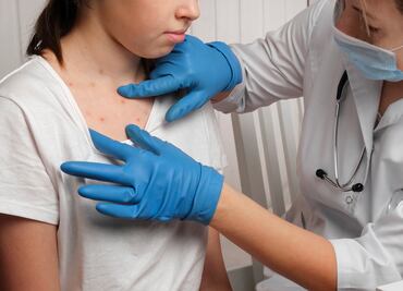 Misteriosa viruela de Alaska alerta a las autoridades; esto es lo que sabe sobre el mortal virus