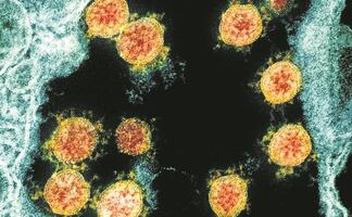 Israel detecta casos de variante "desconocida" de Covid-19 