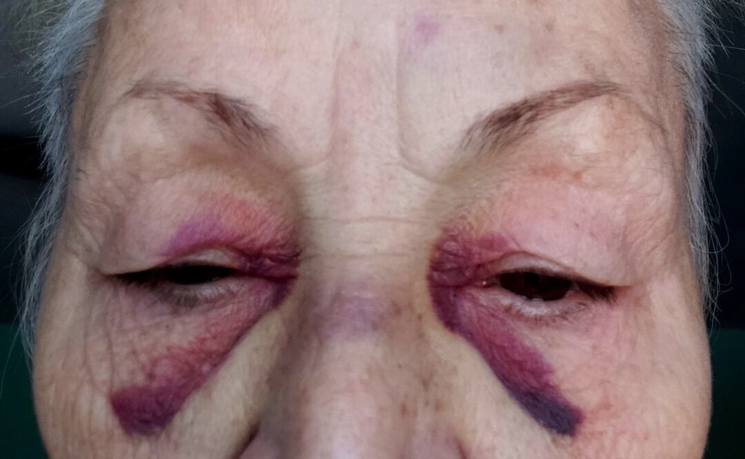 Foto: Facebook Pk Shader