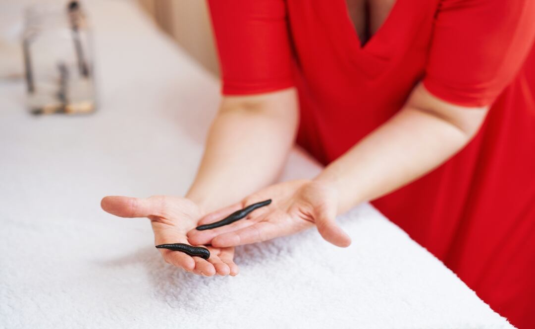 Alertan por gusano barrenador. Muere una joven y hospitalizan a 7. ¿Qué es y cómo se contagia?. Foto: iStock / macniak