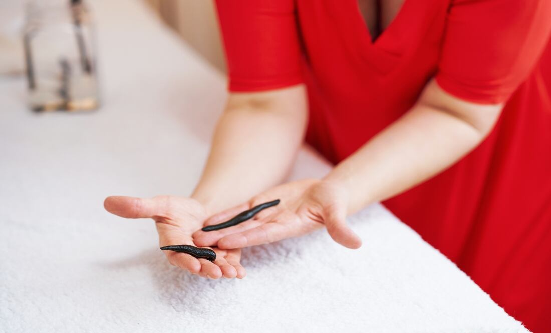 Alertan por gusano barrenador. Muere una joven y hospitalizan a 7. ¿Qué es y cómo se contagia?. Foto: iStock / macniak