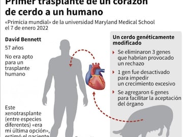 Muere paciente que recibió un trasplante de corazón de cerdo