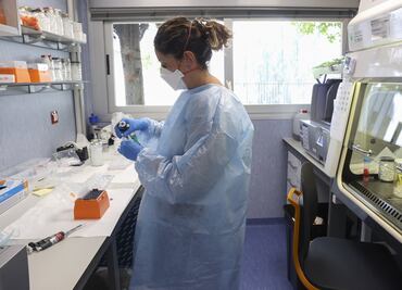 Canadá registra 77 casos de viruela del mono, casi todos en Quebec