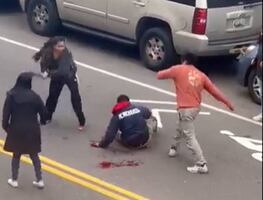 Video. Hombre es atacado brutalmente por lugar de estacionamiento de Nueva York