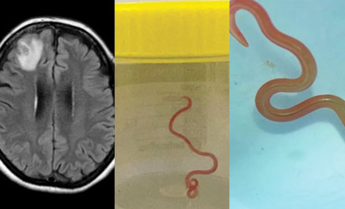 Ophidascaris robertsi/EFE