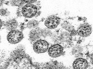 Estudio detalla complicaciones de Covid-19 en niños
