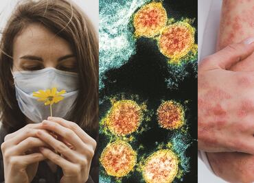 De fatiga a erupciones en la piel: las secuelas del Covid-19, según los CDC