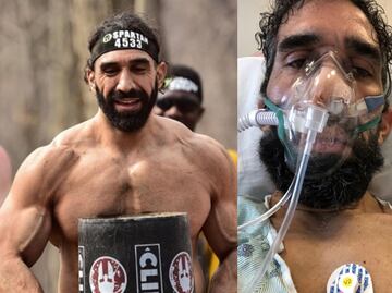 Atleta relata y muestra cómo el coronavirus devastó su cuerpo