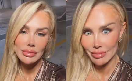 Ninel Conde presume su nuevo rostro y las redes la critican: “Eres otra, ya no eres Ninel”
