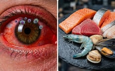 ¿Qué es el nodavirus? Virus en mariscos enciende alerta por contagio y daño ocular en humanos