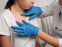 Vacuna contra Sarampión. ¿Quiénes SÍ deben vacunarse y quiénes NO deben recibir dosis? Experto explica