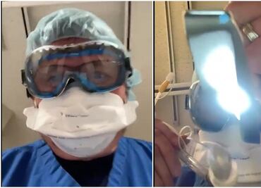 Médico simula en video lo que es estar intubado por Covid-19