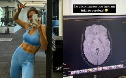 Influencer mexicana sufre infarto cerebral tras aplicación de botox en Dubái; “mis ojos estaban en blanco”