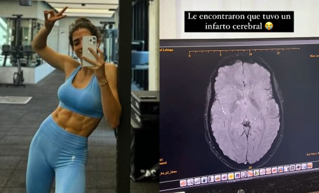 Influencer mexicana sufre infarto cerebral por inyectarse botox en Dubái; “mis ojos estaban en blanco”. Foto: Captura Instagram