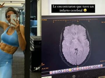Influencer mexicana sufre infarto cerebral tras aplicación de botox en Dubái; “mis ojos estaban en blanco”