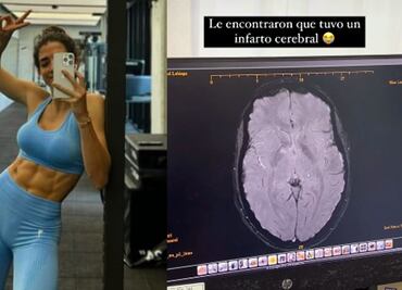 Influencer mexicana sufre infarto cerebral tras aplicación de botox en Dubái; “mis ojos estaban en blanco”