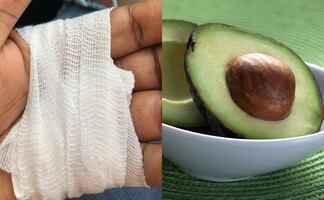 Heridos por cortar aguacate; alertan por accidentes en Estados Unidos