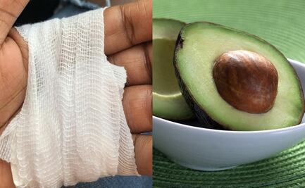 Heridos por cortar aguacate; alertan por accidentes en Estados Unidos