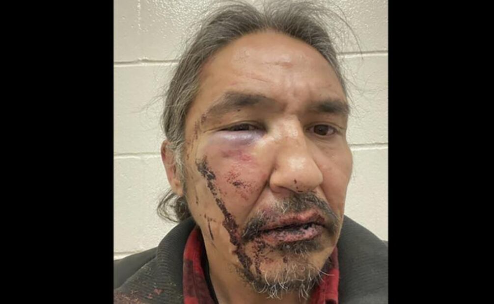Video. Violento arresto policial contra jefe indígena; Trudeau condena acto