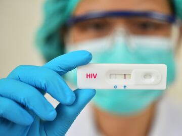 ¿Células del cordón umbilical, la cura para el VIH? mujer de NY se cura